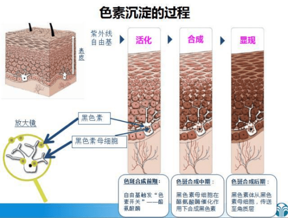 因为美白针真的有用吗，对天生黑皮有用吗，美白的方法