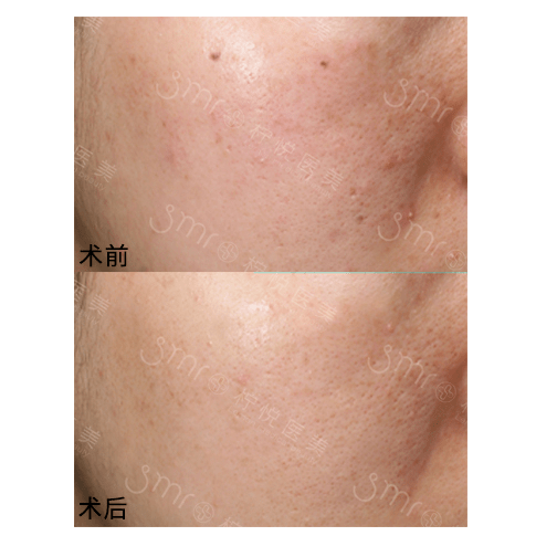 症状不做轻医美很惨,做了轻医美更惨?