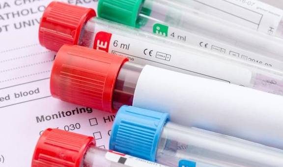 血脂|糖尿病患者需要到医院定期检查,查哪些指标帮您总结好了