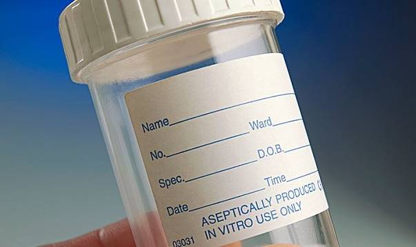 症状|健康测查，哪些表现提示糖尿病患者发生了肾损害？