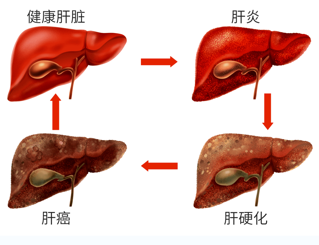 京城名医陈德货中医治疗肝癌医案分享_患者