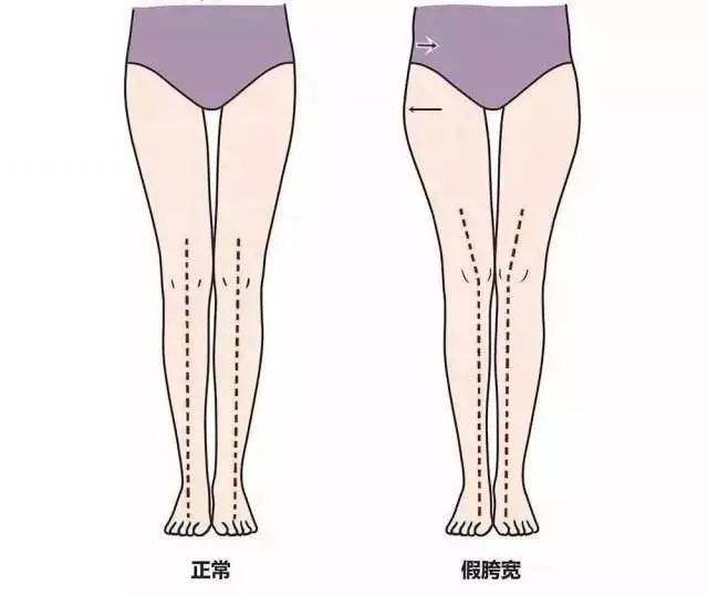 下半身 “梨型身材”怎么穿显瘦？学这4个遮肉法，堪称“削肉神器”