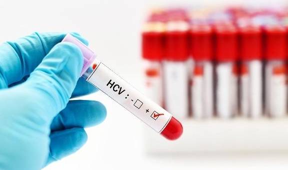 血液|做检查时，发现肌酐值偏高？扒出4个“导火索”