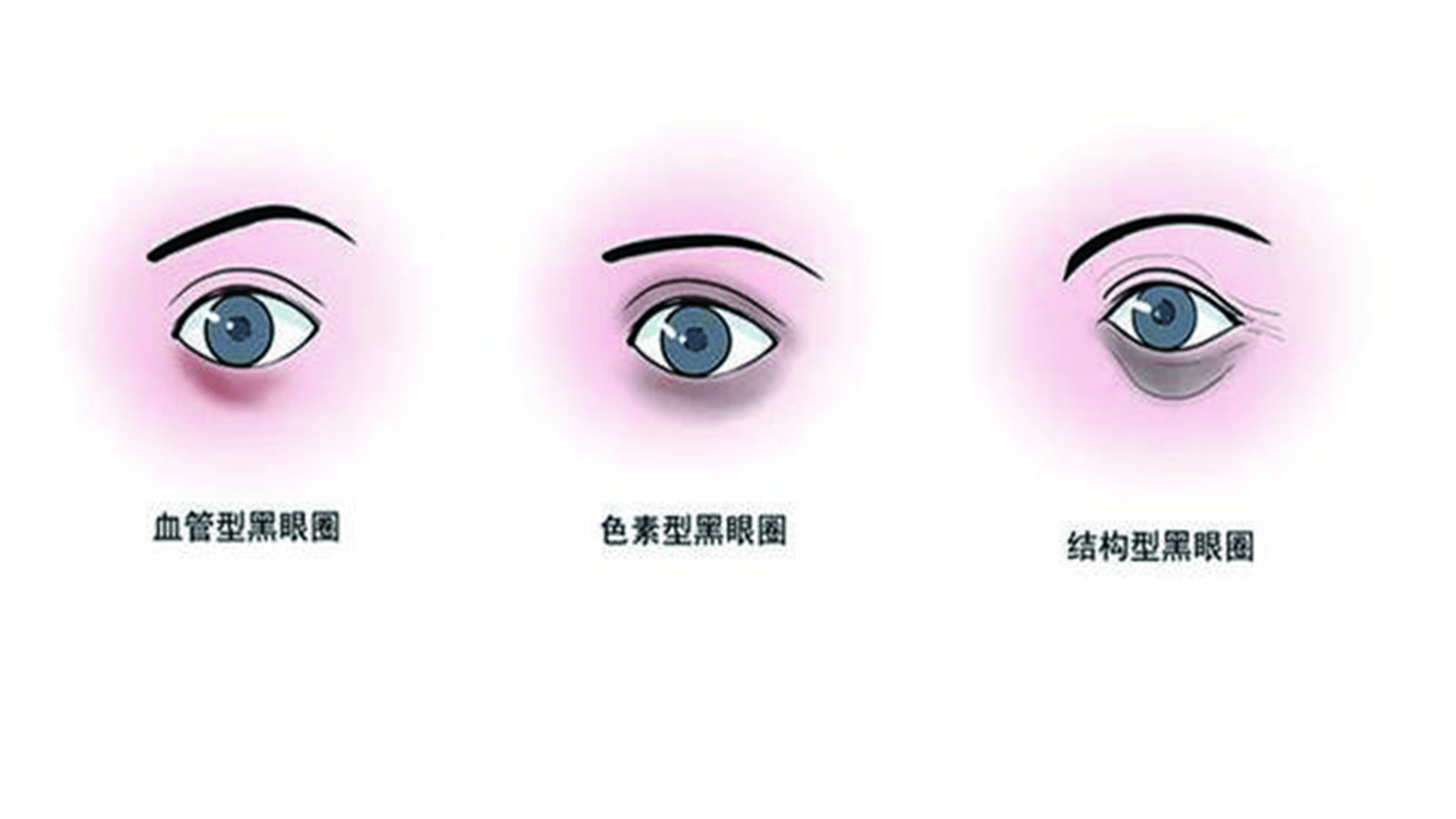 年轻人|黑眼圈门诊，你有兴趣吗？网友的评论亮了