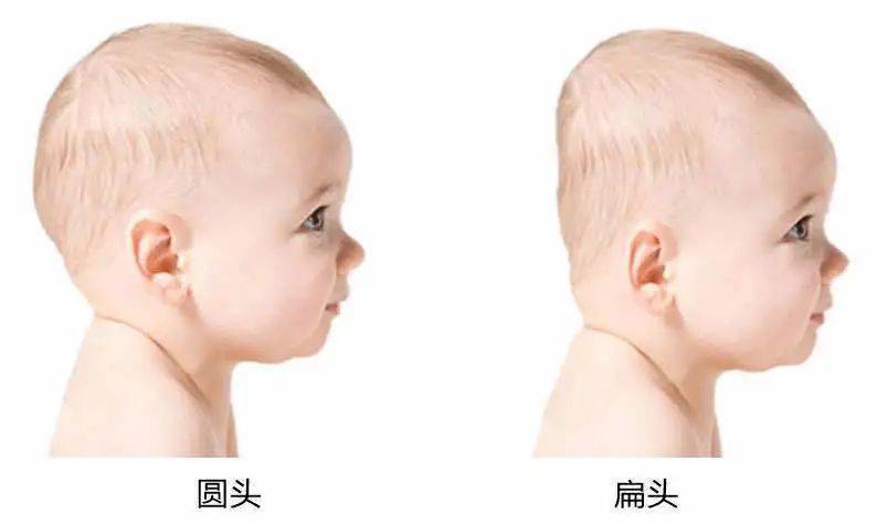 婴儿怎样才能睡成圆头 0e01d56bf0de4bd7b6fbef6b6de4a0cb.jpeg