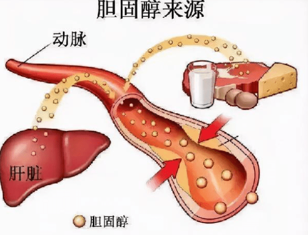 食物降转氨酶最快的方法_如何快速降低转氨酶食物_食物降低快速转氨酶的原理