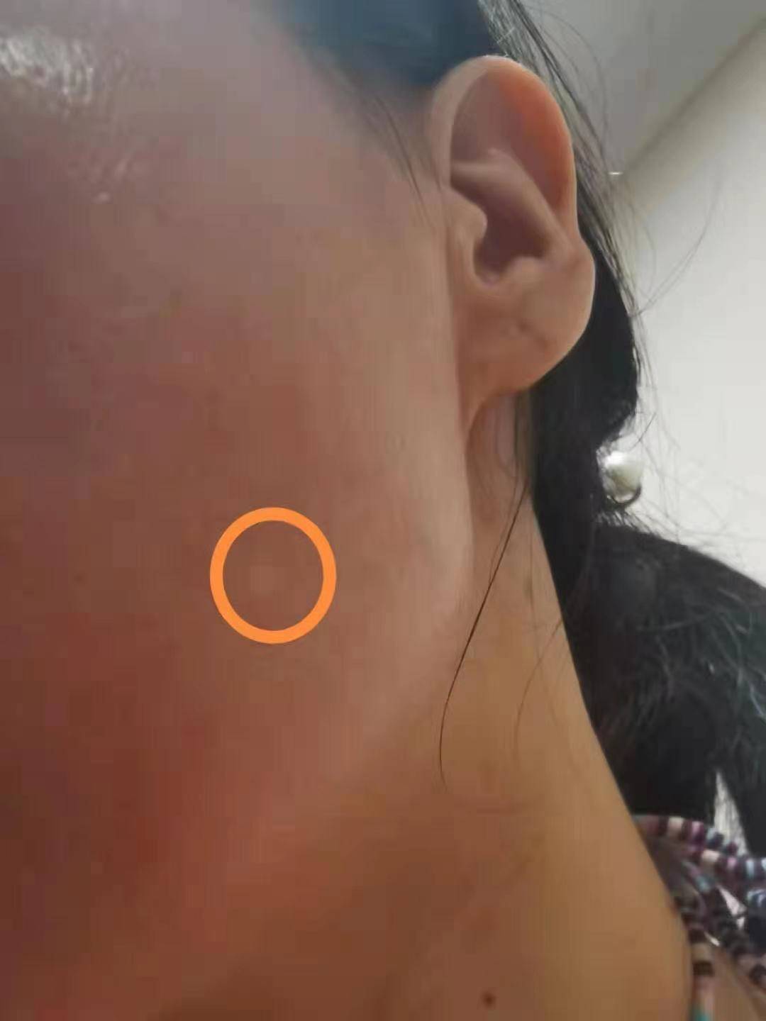 白点碧蒂曼诗3D仿生膏：脸上不知道为什么会起白点，应该怎么处理？