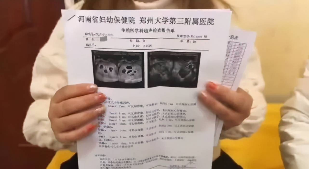 郑州女子怀上八胞胎原因曝光!医生提醒这种药慎用