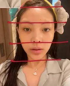 因为她是如何从万人骂的老巫婆变美学界整形模版的？