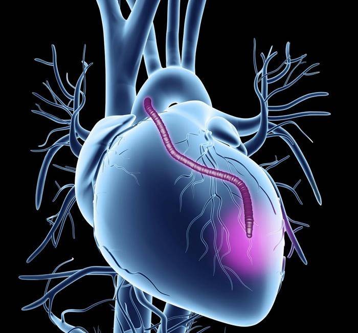 什么是动脉血管痉挛 7946a020c74e4edbaa662a2f406ead1f.jpeg