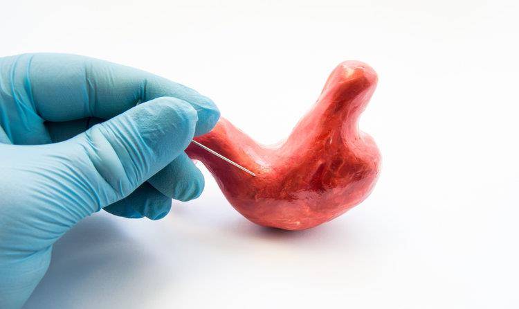 温度|6个特征一个都没有，你就“偷着乐”吧，胃癌离你还很远