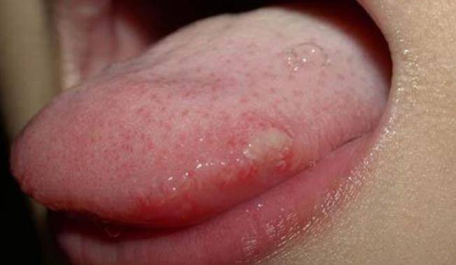 年代|25岁情侣双双查出糖尿病，医生：什么年代了，厨房这2物，赶紧扔