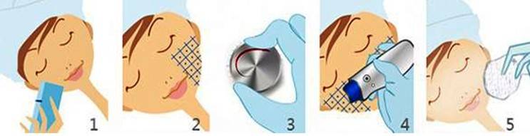 玛吉热玛吉的好处与弊端:动辄上万价格的热玛吉值得做吗?