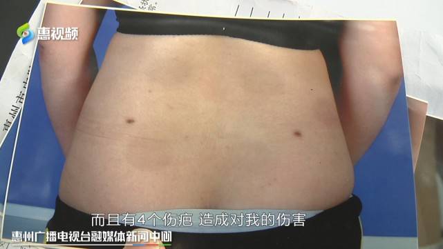 惠州美容瘦身不成功 记者跑腿商家退费