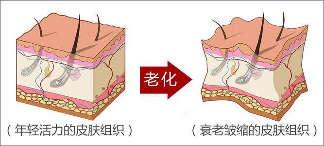 经验为什么拉皮手术成为了很多人的选择？