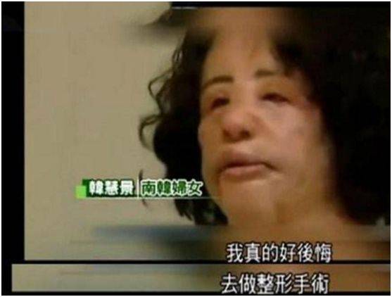 才会曾经的她貌美如花，没成想亲手毁了自己，极端整容如今成这样！