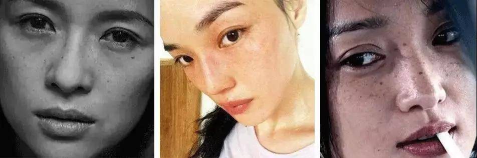方法想要彻底下“斑”？别再踩雷了，真正有效的祛斑方法在这里...