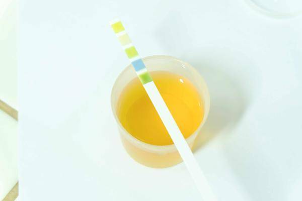 严重|肝病发生前，身体或出现这5种不适，发现后，及时检查，控制病情