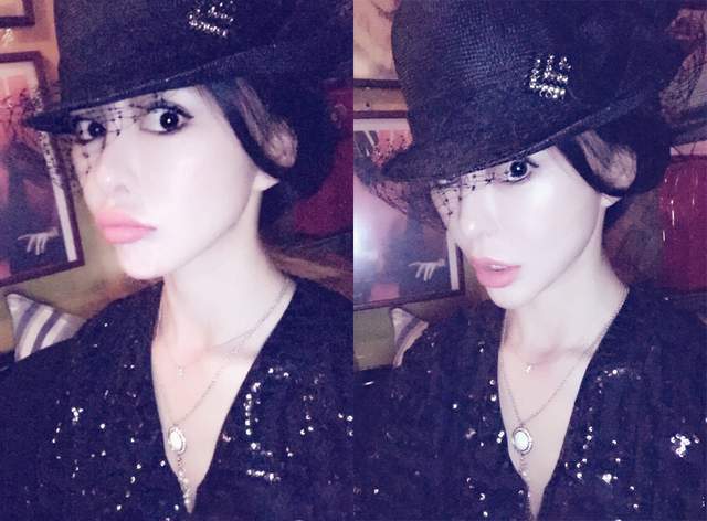 黄夏蕙七位整容失败女星，各有故事，有人销声匿迹，有人二婚被宠成公主