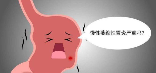 be9777da377a400798ccda0f08db8b79.jpeg