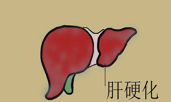 治療|得了肝硬化，還有沒有治愈的可能？常見的治療手段有哪些？