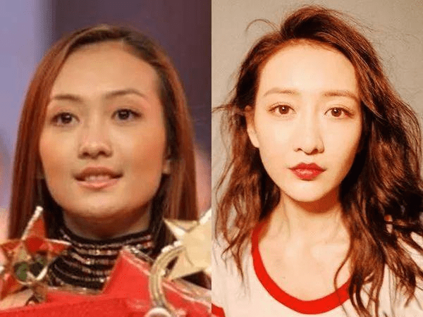 下巴明星的N种“假下巴”，尖到戳死人，翘成老巫婆，一个比一个怪异