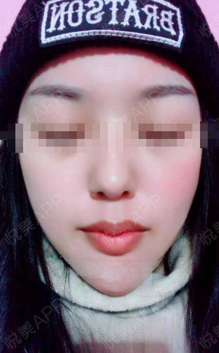 下巴明星的N种“假下巴”，尖到戳死人，翘成老巫婆，一个比一个怪异