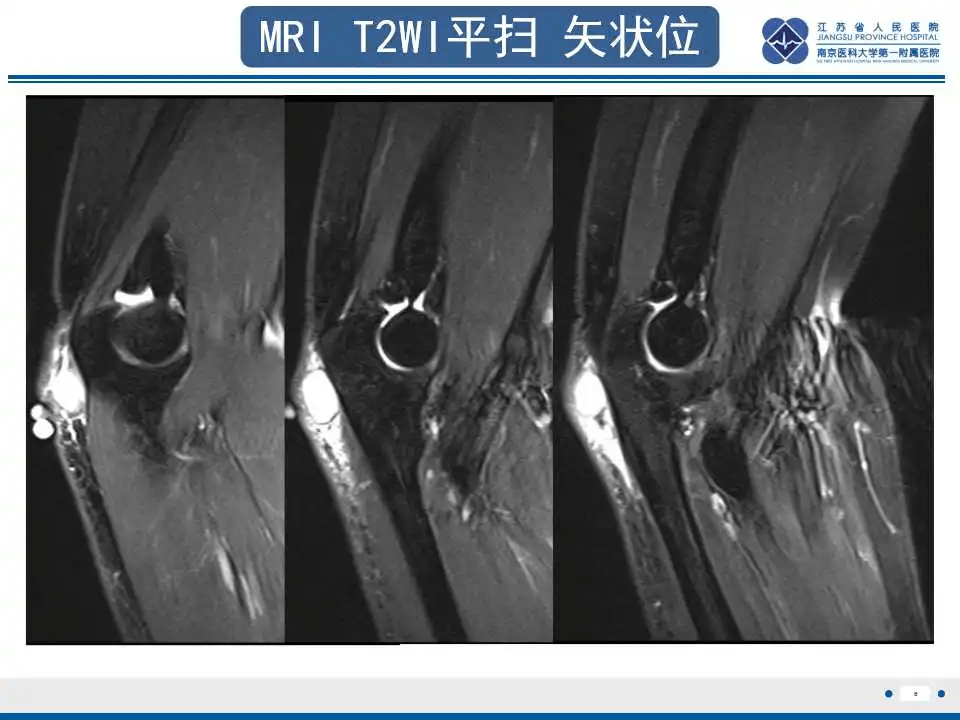 结节性筋膜炎影像表现_平台_版权_声明