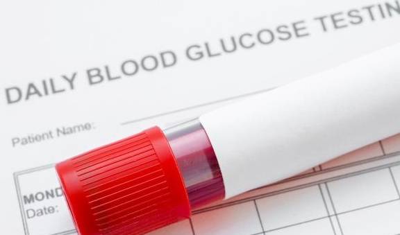 饮食|测血糖,空腹血糖和餐后血糖哪个更准?这两个指标的意义何在?