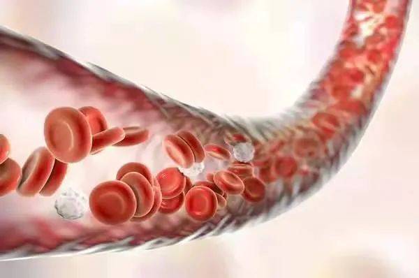 理想|什么是缺血性卒中最理想的治疗办法？