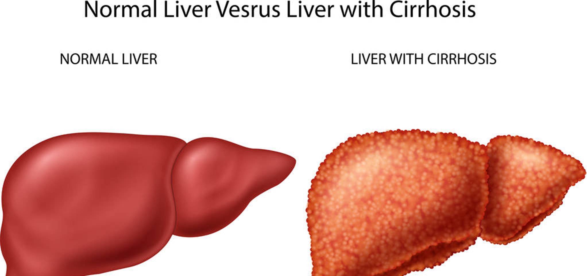 人体|肝不舒服,这3个因素或是关键,请及时避开,多吃它,肝或感激你