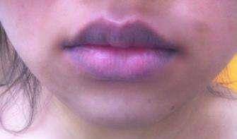 眼睛|肝不好多半是“拖”出来，身体有这3种“迹象”占1种，及时检查