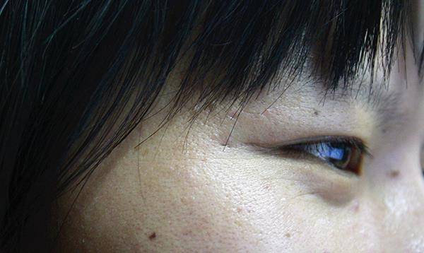 进行|肝硬化是“哑巴病”？身体早就给出警告，别一再错过