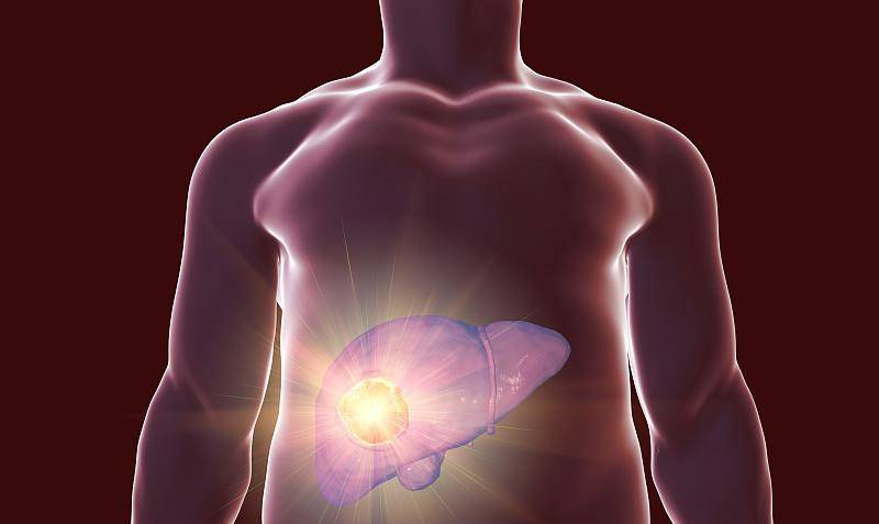 降低|肝脏病变，上半身会有“暗示”吗？文章带你了解