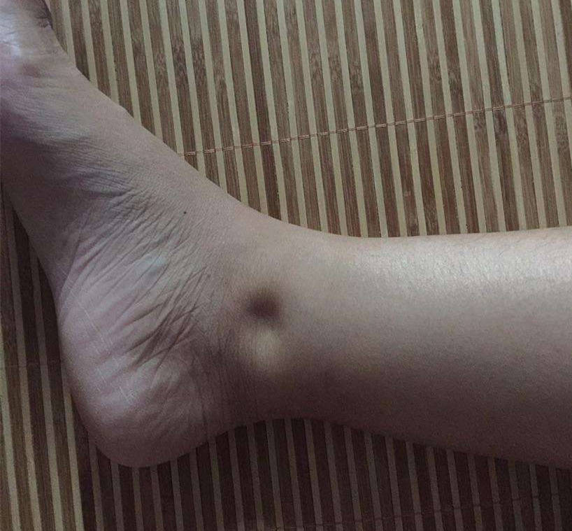 因为|大病一来脚先知。6表现说明肾危险，做好3件事，养好肾