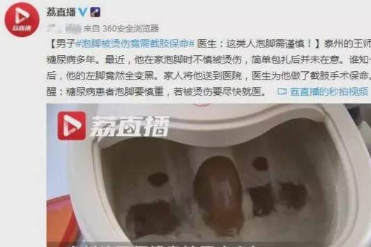 控制|男子热水泡脚，最后竟要截肢？这个错误很多人还在犯