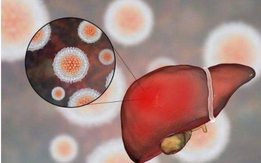 治疗|乙肝患者福音，身体出现4种情况要留意，选择正确药物治疗很重要