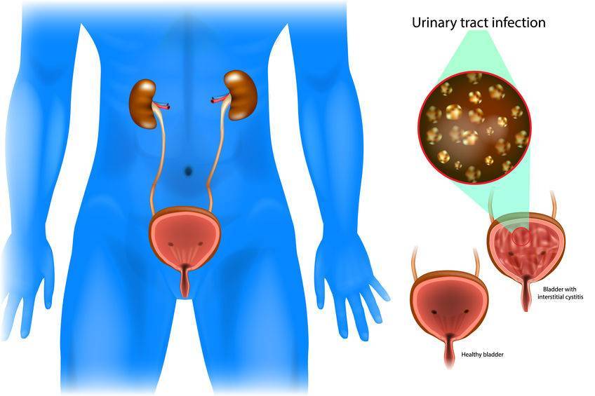膀胱在人体的位置图图片