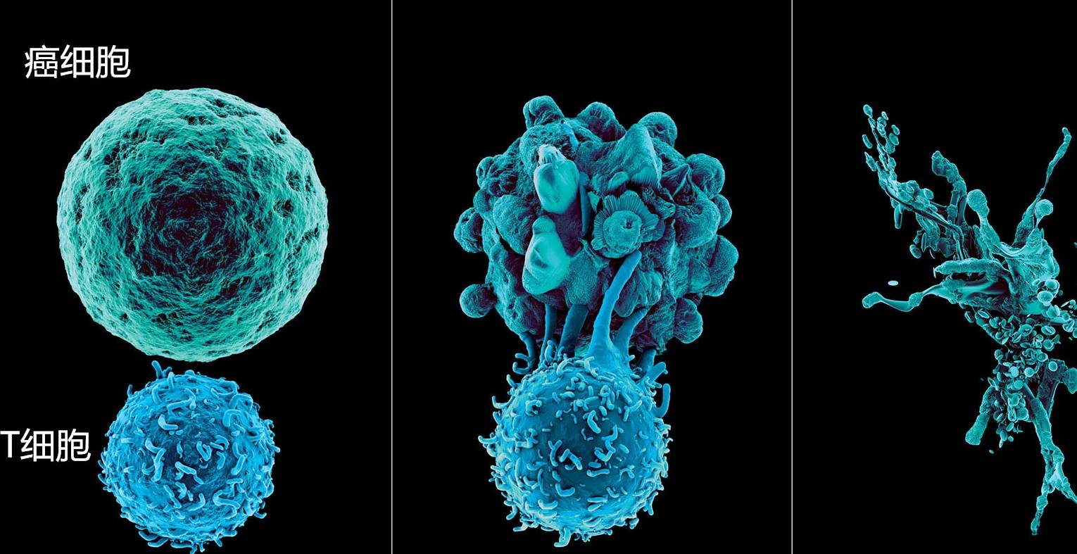 免疫疗法的全部类型 及对应可改善的癌症 细胞 治疗 化疗