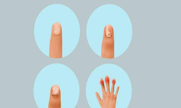 眼睛|肝脏好不好，手先知！肝脏出现问题，手上会有什么变化？