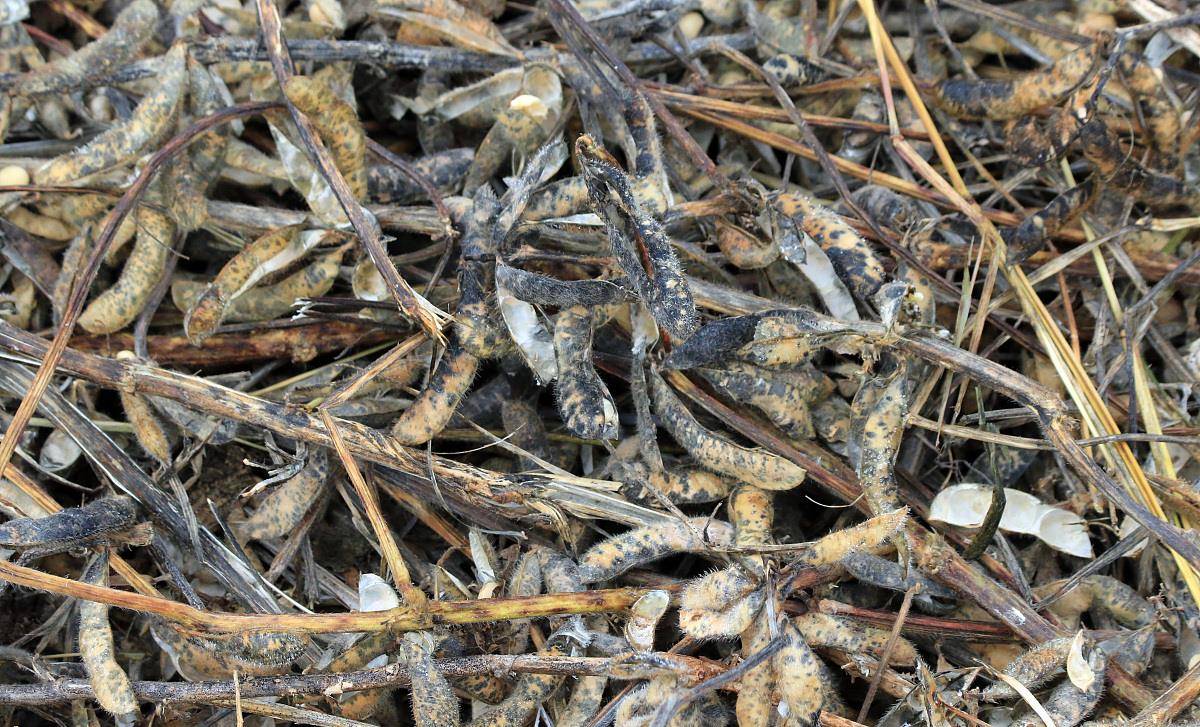 毒素|肝脏开始变硬，身体会露出哪些“破绽”？