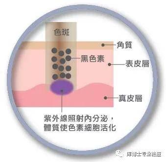 讲堂库博士祛痘小讲堂 | 我们脸上为什么会长斑？