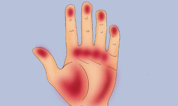 眼睛|肝脏好不好，手先知！肝脏出现问题，手上会有什么变化？