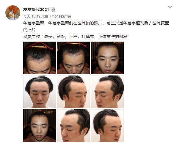 调整娱乐圈男星换脸大比拼：有人削骨，有人隆鼻，有人直接“换头”