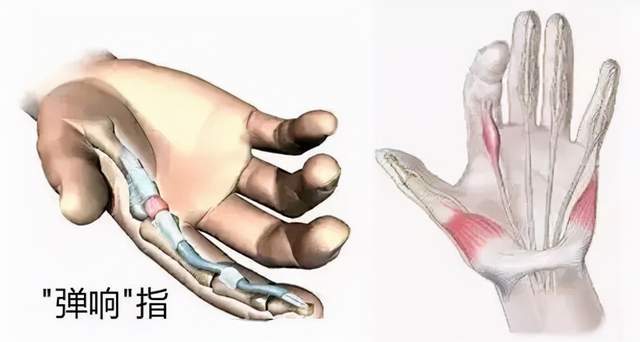 腰椎间盘_膝关节_症状