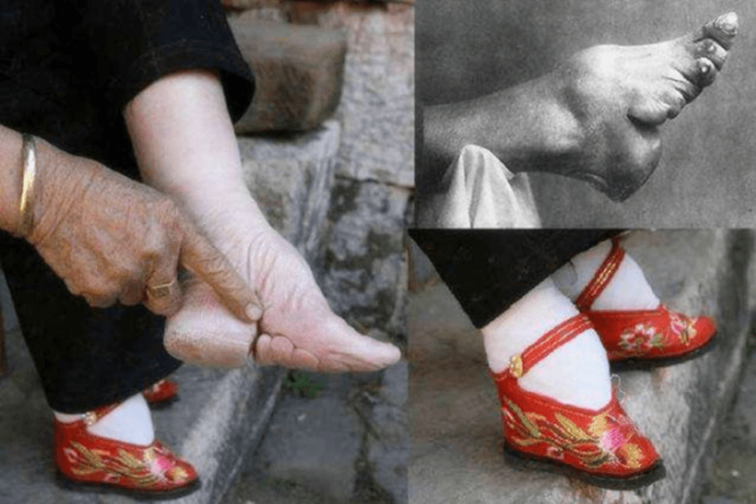 古代男人为什么会喜欢缠足女 这一陋俗 仍令人深恶痛绝 小脚女人 脚趾 足部