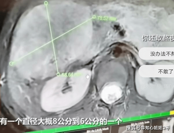 女人长期熬夜适合吃什么最好 4f63b03f24604a918b35b4c301aad6d1.png