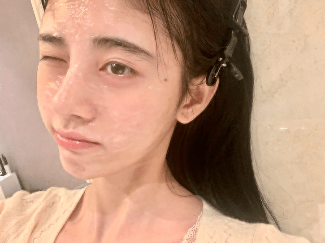 后遗症那些乱整鼻子的女星还好吗？后遗症一大堆，杨幂金晨都开始崩了