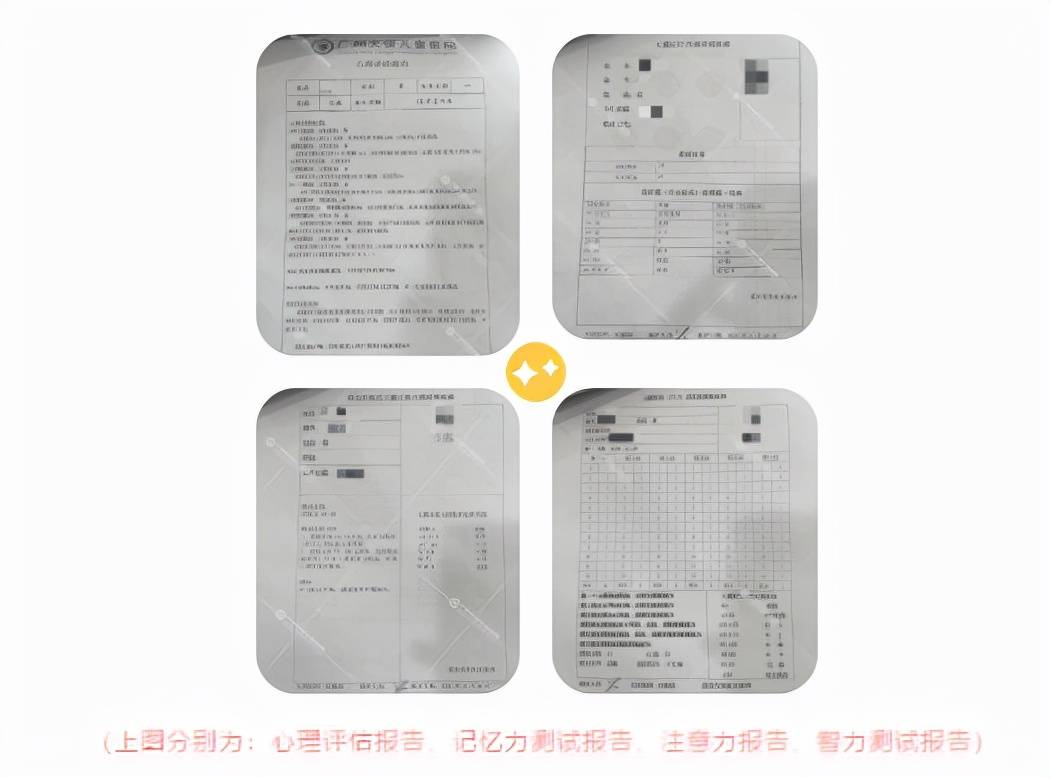 脑电图报告单样板图片