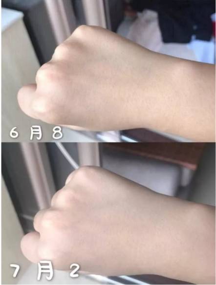 因为干货分享 如何让皮肤白得发光